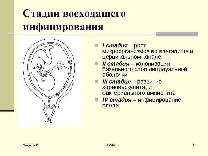 Стадии восходящего инфицирования n I стадия – рост микроорганизмов во влагалище и цервикальном канале