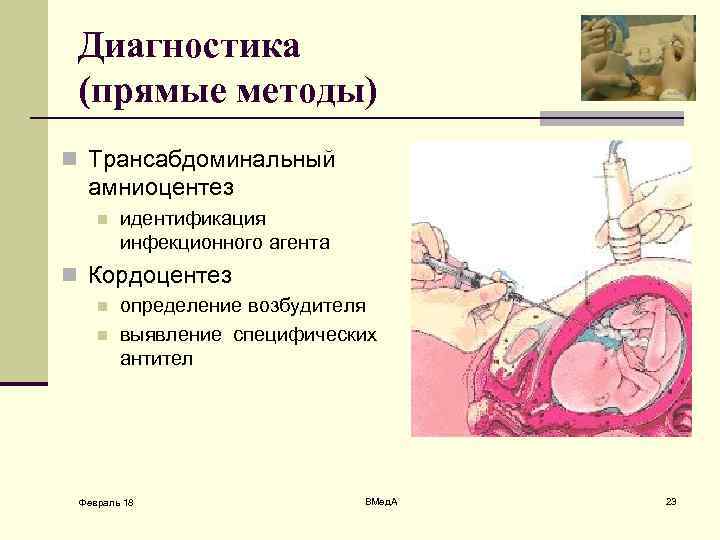 Диагностика (прямые методы) n Трансабдоминальный амниоцентез n идентификация инфекционного агента n Кордоцентез n n