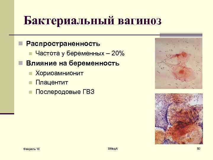 Бактериальный вагиноз n Распространенность n Частота у беременных – 20% n Влияние на беременность