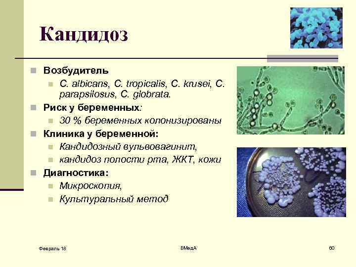 Кандидоз n Возбудитель С. albicans, С. tropicalis, С. krusei, С. parapsilosus, С. globrata. n