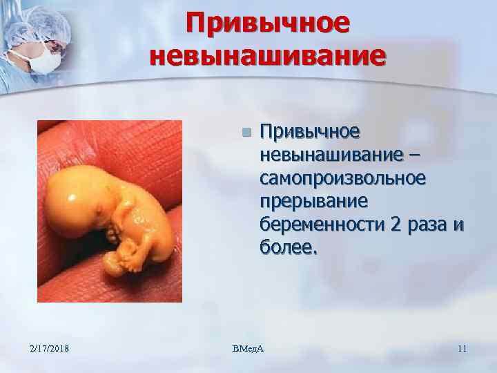 Привычное невынашивание n 2/17/2018 Привычное невынашивание – самопроизвольное прерывание беременности 2 раза и более.