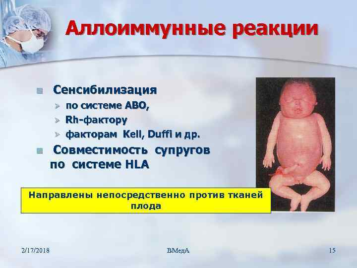 Аллоиммунные реакции n Сенсибилизация Ø Ø Ø n по системе АВО, Rh-фактору факторам Kell,