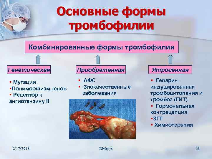 Основные формы тромбофилии Комбинированные формы тромбофилии Генетическая Приобретенная Ятрогенная § Мутации §Полиморфизм генов §