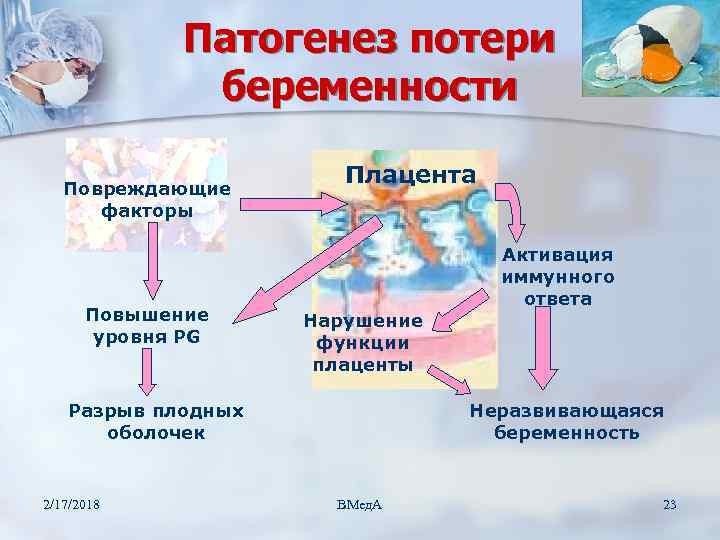 Патогенез потери беременности Повреждающие факторы Повышение уровня PG Плацента Активация иммунного ответа Нарушение функции