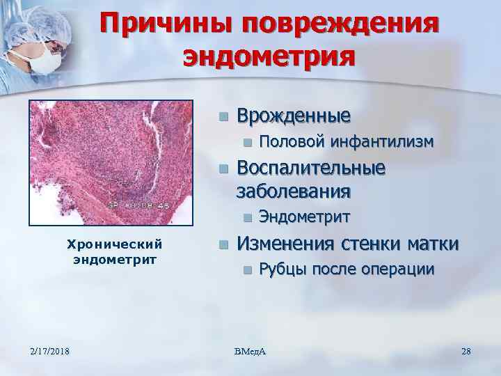 Послеродовой острый гнойно катаральный эндометрит