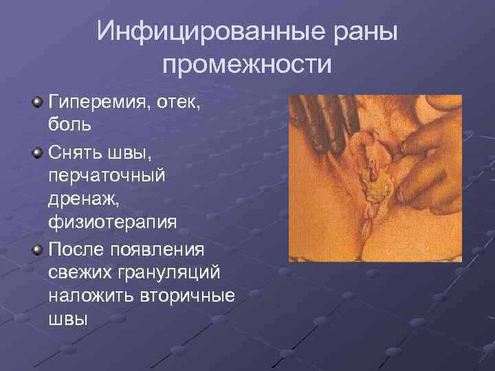 Инфицированные раны промежности Гиперемия, отек, боль Снять швы, перчаточный дренаж, физиотерапия После появления свежих