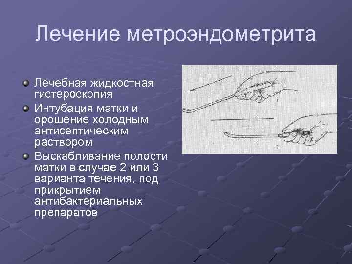 Лечение метроэндометрита Лечебная жидкостная гистероскопия Интубация матки и орошение холодным антисептическим раствором Выскабливание полости