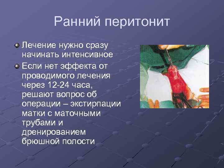 Ранний перитонит Лечение нужно сразу начинать интенсивное Если нет эффекта от проводимого лечения через