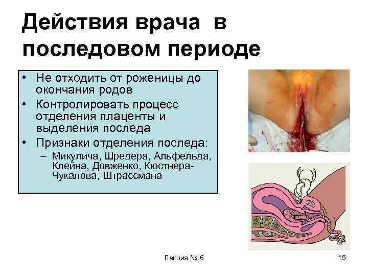 Действия врача в последовом периоде • Не отходить от роженицы до окончания родов •