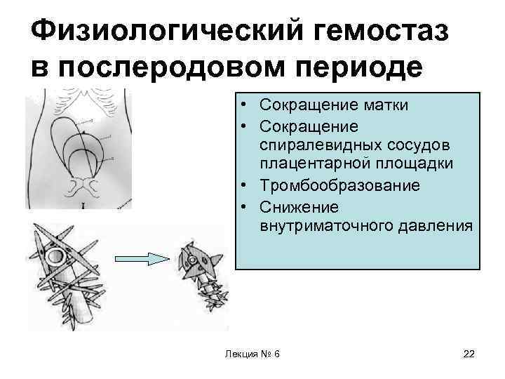 Физиологический гемостаз в послеродовом периоде • Сокращение матки • Сокращение спиралевидных сосудов плацентарной площадки