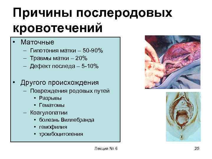 Причины послеродовых кровотечений • Маточные – Гипотония матки – 50 -90% – Травмы матки