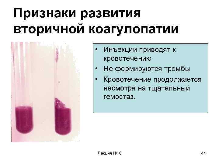 Признаки развития вторичной коагулопатии • Инъекции приводят к кровотечению • Не формируются тромбы •