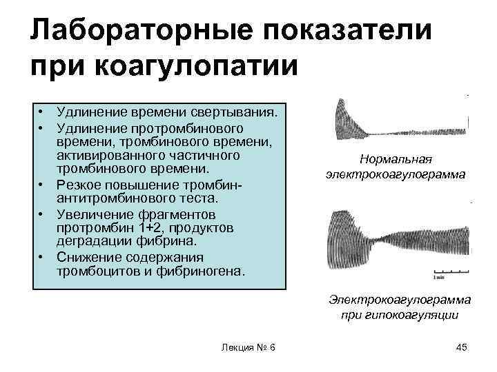 Лабораторные показатели при коагулопатии • Удлинение времени свертывания. • Удлинение протромбинового времени, активированного частичного