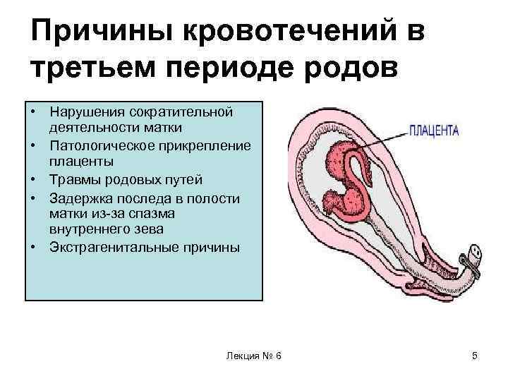 Причины кровотечений в третьем периоде родов • Нарушения сократительной деятельности матки • Патологическое прикрепление