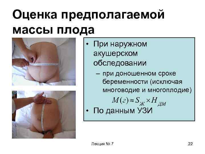 Оценка предполагаемой массы плода • При наружном акушерском обследовании – при доношенном сроке беременности
