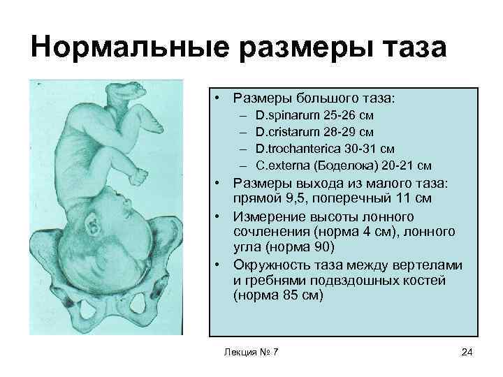 Нормальные размеры таза • Размеры большого таза: – – D. spinarum 25 -26 см