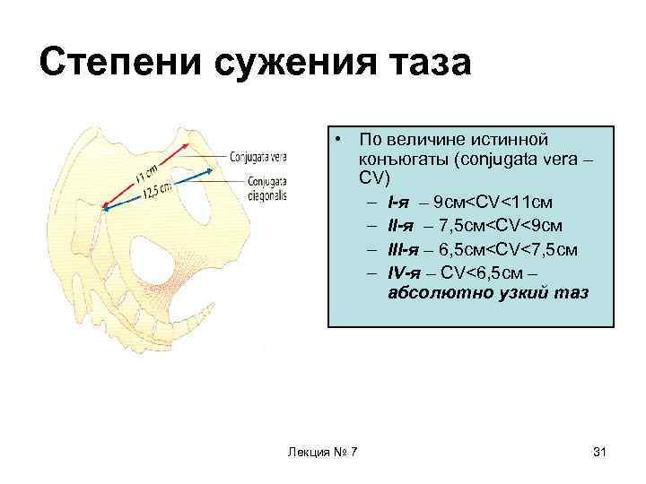 Конъюгаты таза