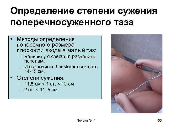 Определение степени сужения поперечносуженного таза • Методы определения поперечного размера плоскости входа в малый