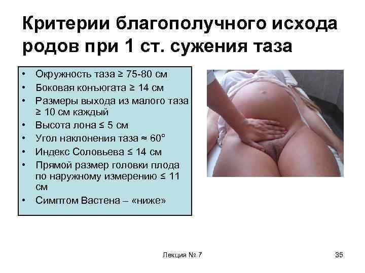 Критерии благополучного исхода родов при 1 ст. сужения таза • Окружность таза ≥ 75