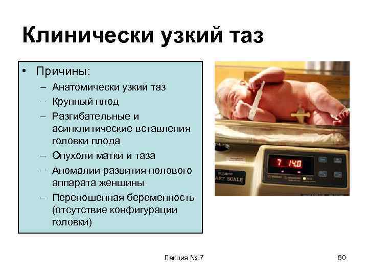 Орст 1 степени при беременности что это. Клинический узкий таз причины. Диагностический критерий узкого таза. Причины клинически узкого таза.