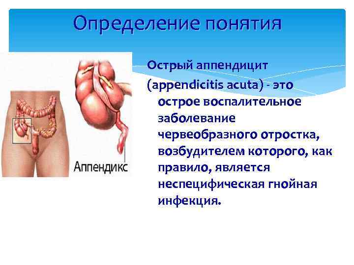 Определение понятия Острый аппендицит (арpendicitis асuta) - это острое воспалительное заболевание червеобразного отростка, возбудителем