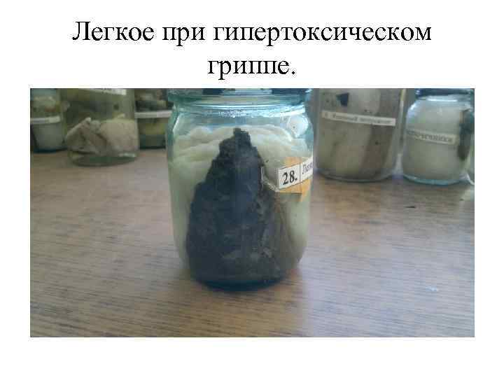 Легкое при гипертоксическом гриппе. 