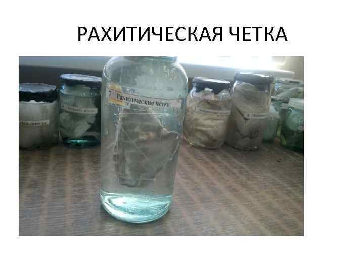 РАХИТИЧЕСКАЯ ЧЕТКА 