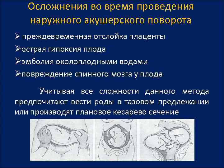 Отслойка плаценты карта вызова