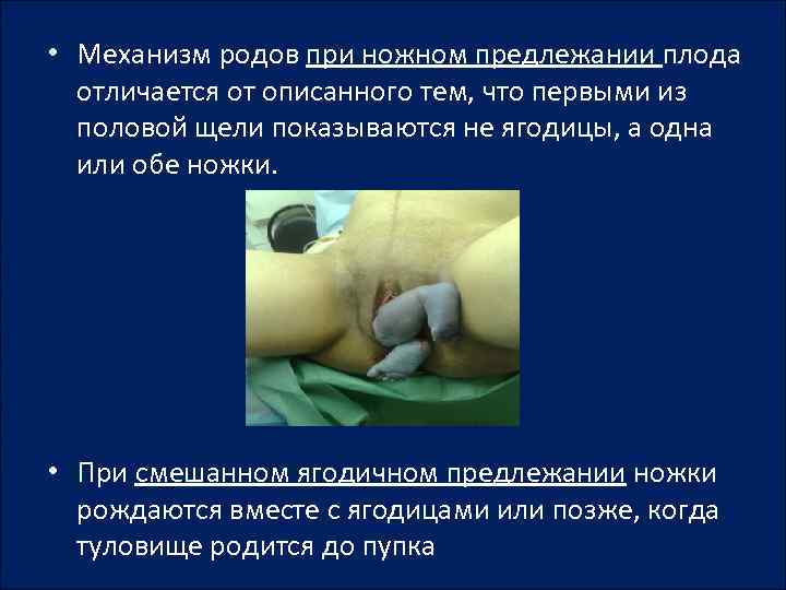  • Механизм родов при ножном предлежании плода отличается от описанного тем, что первыми