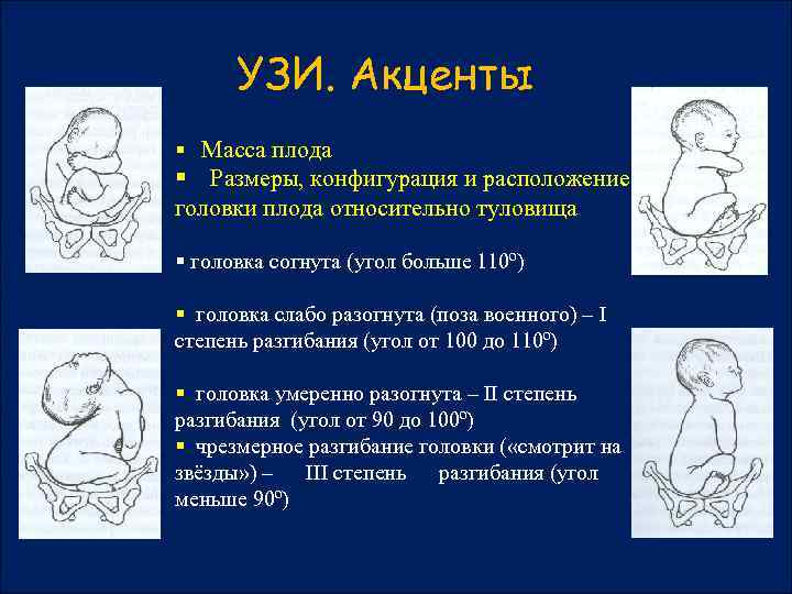 УЗИ. Акценты § Масса плода § Размеры, конфигурация и расположение головки плода относительно туловища