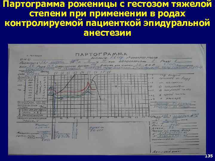 Нарисуйте и заполните анестезиологическую карту