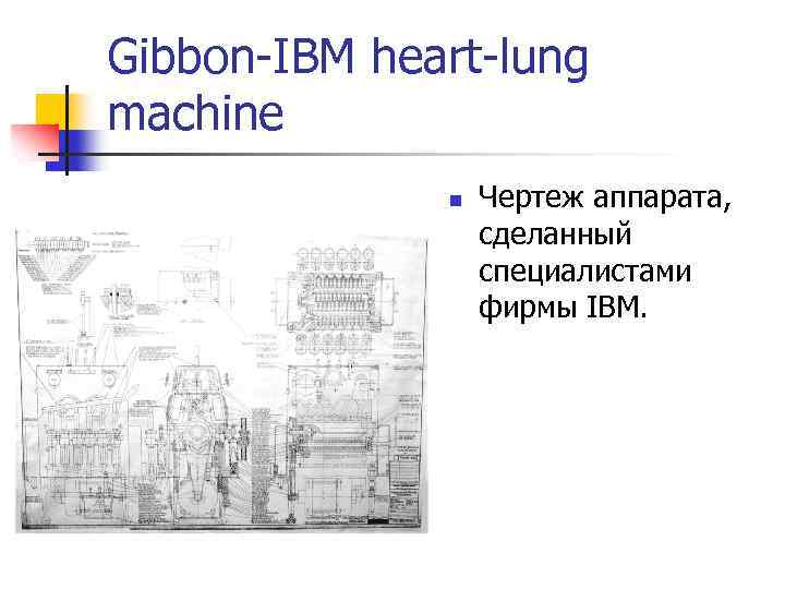 Gibbon-IBM heart-lung machine n Чертеж аппарата, сделанный специалистами фирмы IBM. 