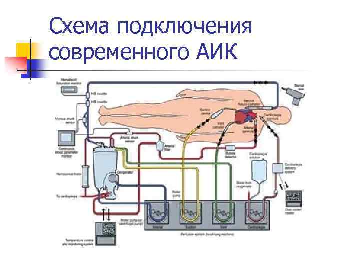 Схема подключения современного АИК 