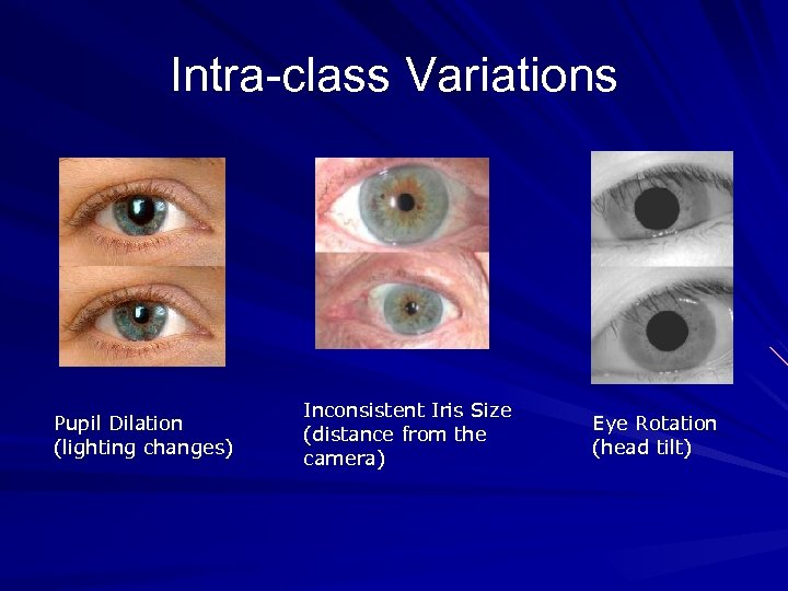 Intra-class Variations Pupil Dilation (lighting changes) Inconsistent Iris Size (distance from the camera) Eye