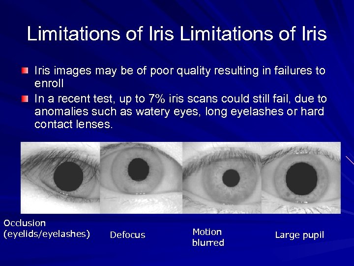 Limitations of Iris images may be of poor quality resulting in failures to enroll