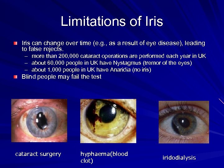 Limitations of Iris can change over time (e. g. , as a result of