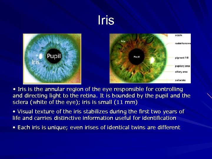 Iris • Iris is the annular region of the eye responsible for controlling and