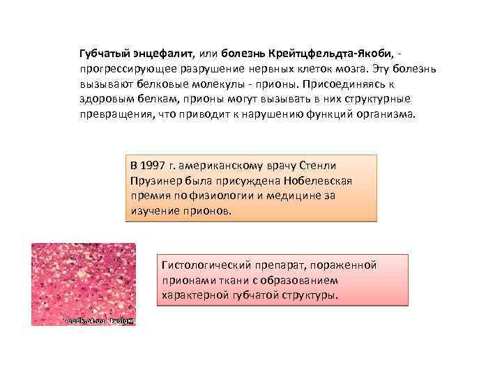 Губчатый энцефалит, или болезнь Крейтцфельдта-Якоби, - прогрессирующее разрушение нервных клеток мозга. Эту болезнь вызывают