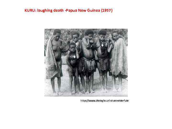 KURU: laughing death -Papua New Guinea (1957) http: //www. biologie. uni-duesseldorf. de 