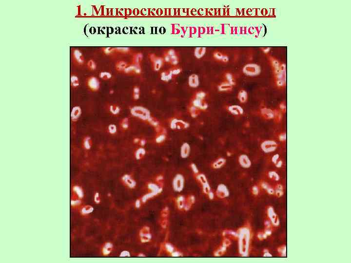 1. Микроскопический метод (окраска по Бурри-Гинсу) 