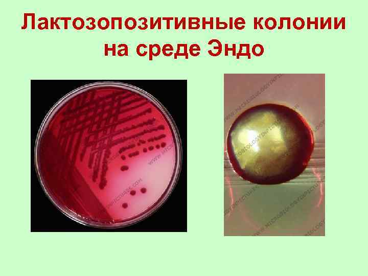 Лактозопозитивные колонии на среде Эндо 