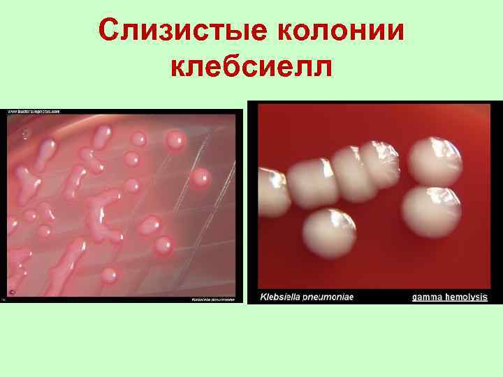 Слизистые колонии клебсиелл 