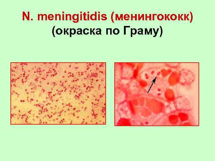 N. meningitidis (менингококк) (окраска по Граму) 