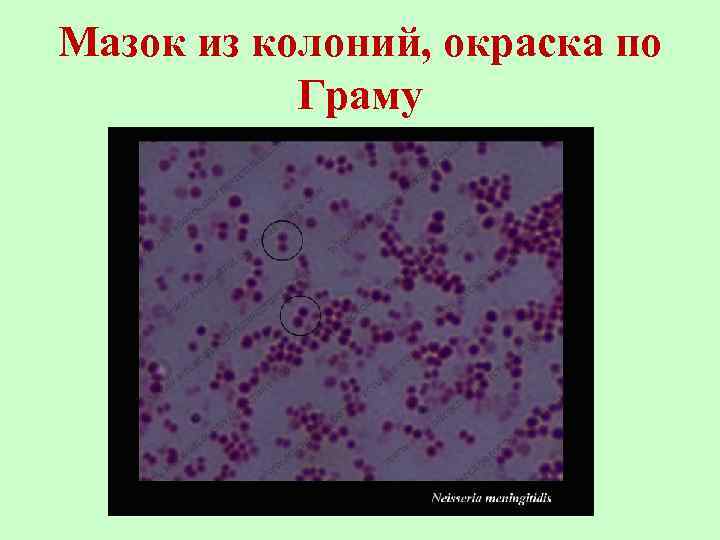 Мазок из колоний, окраска по Граму 
