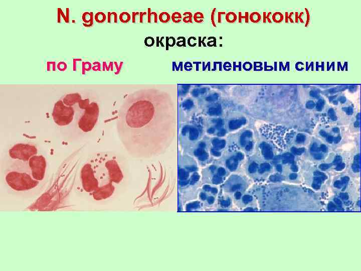 N. gonorrhoeae (гонококк) окраска: по Граму метиленовым синим 