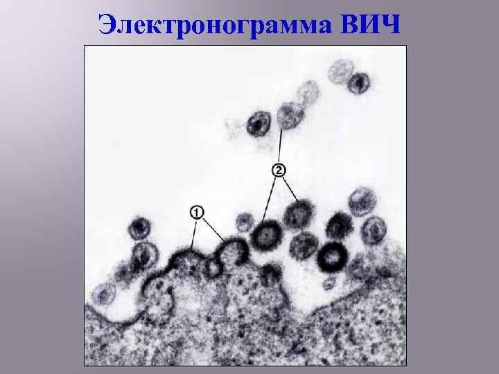 Электронограмма ВИЧ 