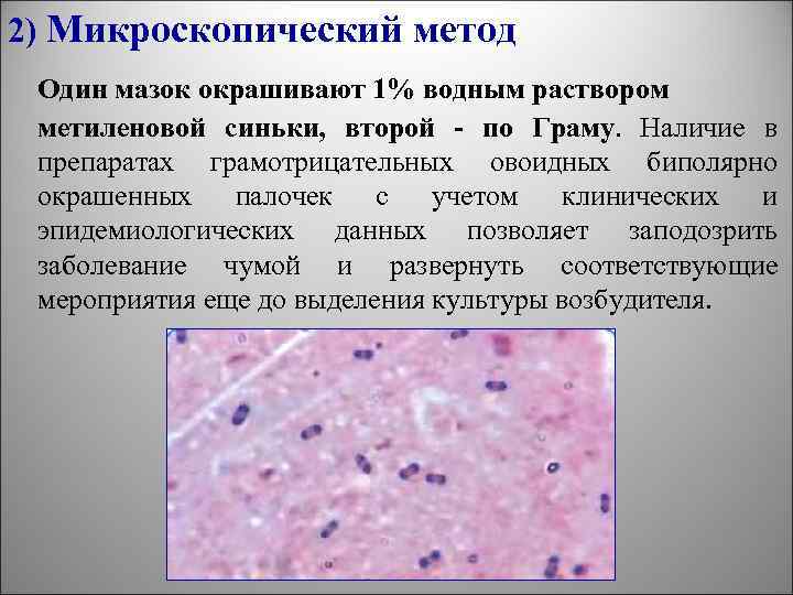 2) Микроскопический метод Один мазок окрашивают 1% водным раствором метиленовой синьки, второй - по