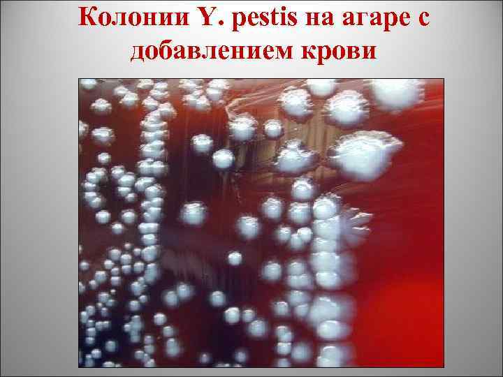 Колонии Y. pestis на агаре с добавлением крови 