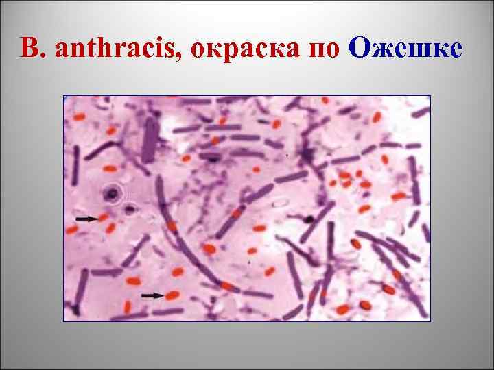 B. anthracis, окраска по Ожешке 