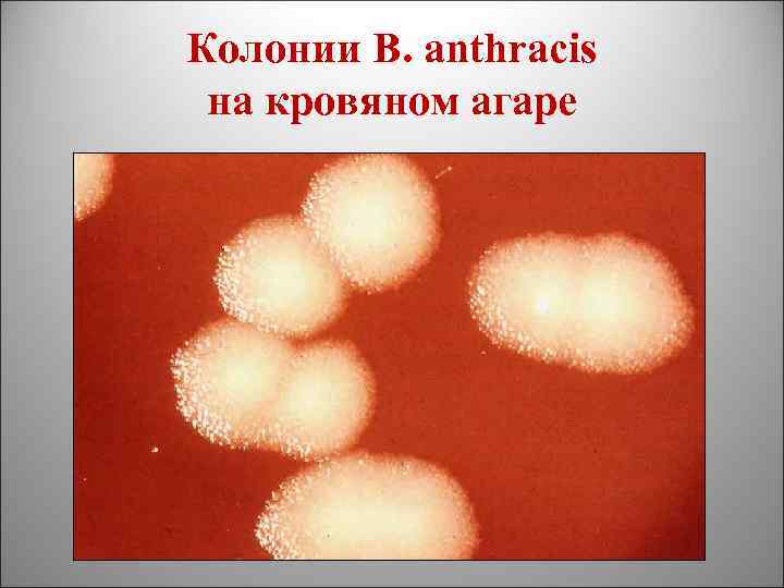 Колонии B. anthracis на кровяном агаре 